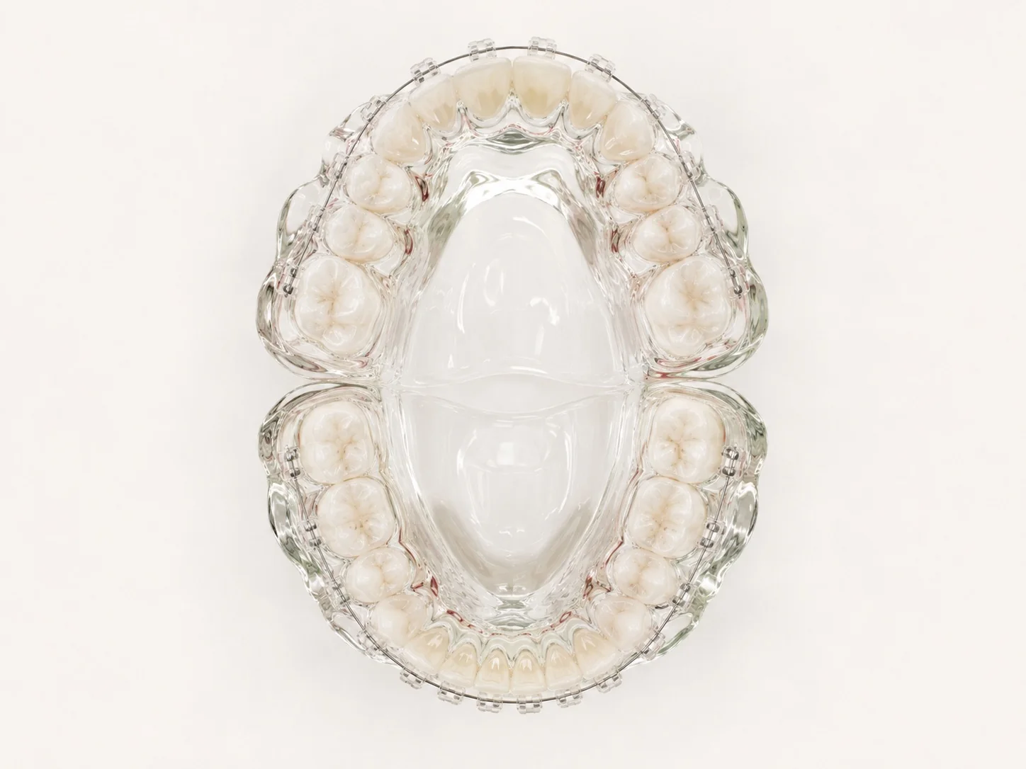Top view of a tooth model with braces prepared in a glass and ceramic aesthetic
